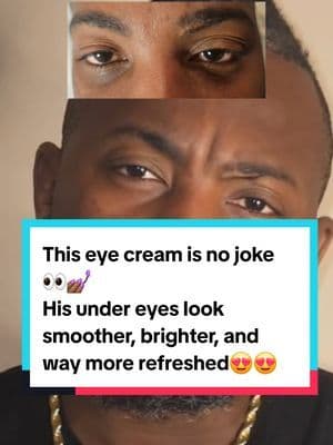 I put my husband on to this Anua Eye Cream and now he looks like he’s been sleeping 10 hours a night 😂 The mix of caffeine and retinol works like magic 👏🏾 It’s hydrating, smooth, and worth every bit of the hype. Can’t say I never put you on. ... #fyp #abbydames #viralbeauty #tiktokshopfinds #koreanskincare #eyecream #undereyecare #retinolskincare #skincareforhim #darkcirclecream #TikTokShopRestock #tiktokshopcreatorpicks #BahamianCreator #BahamianInfluencer #CaribbeanCreator #CaribbeanInfluencer #Austininfluencer #Austincreator #Texasinfluencer #Texascreator #UGC #TikTokpartner #TikTokShopFallDealsForYou #AutumnLiving #TikTokShopBlackFriday #TikTokShopCyberMonday #SuperBrandClub #ViralOnTikTokShop #anuaskincare #kbeautyfinds #antiagingcream #skincareroutine #kbeautytrend #mensskincare #skincareviral #koreanskincaretiktok #tiktokshopbeauty #retinoleyecream #caffeineeyecream #brighteningeyecream #hydratingeyecream #glowyskin #selfcaregoals #beautyfinds