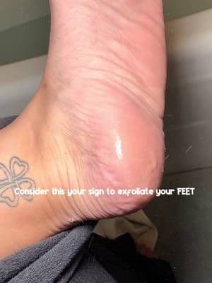 Apparently you can get the best part of a pedicure without actually booking the pedicure 👀🦶🏻 #drmelaxin #peelshot #fo