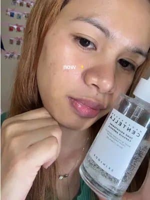 Glow missing? Bring it back! #GoViralWithSKIN1004Challenge #SKIN1004White #skin1004 #centella #TikTokMadeMeBuyIt @skin1004_challenge @SKIN1004 US