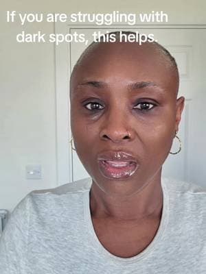 I love how this feels on my skin @AXIS-Y #axisy #darkspotserum #brightskin #dealdrop #tiktokmademebuyit
