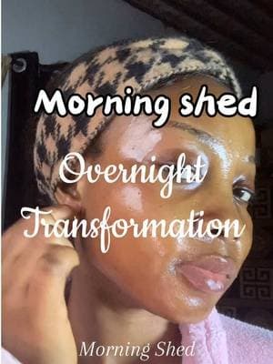 Morning Shed🫣Overnight mask transformation …. The glow? I can’t @medicube global @medicube_official #medicube #amazon #amazonmusthaves #wrappingmask #glassskin