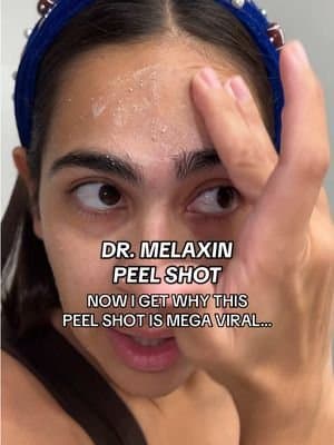 I know I’m just as amazed as you!! This thing works and it’s great for sensitive skin, it didn’t leave my skin red at all!! 😱🤯 #drmelaxin #drmelaxinpeelshot #tiktokshopcreatorpicks #ttshopfinds