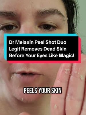 Dr Melaxin Peel Shot is the craziest stuff! It's made from Rice Bran and all you do is put it on your face and gently rub it, and all of the dead skin layers peel right off before your eyes! this stuff makes my skin feel so smooth and I have had zero acne on my face since I began using this stuff. you've got to try it! #drmelaxin #skinpeel #exfoliate #exfoliating #exfoliatinggel #facial #facialtreatment #skincare #skincareroutine #skincarereview #skincarerecommendations #skincareregimen #skincaretips #skincare101 #skincareproduct #skincareproductsmusthave #skincareproductsthatwork #deadskin #cleanskin #cleanskincare #smoothskin #softskin #tiktokshopfinds #honestreview #springsale #viralproducts #skinbrightning #tiktokshopspringglowup #tiktokshopspringsale