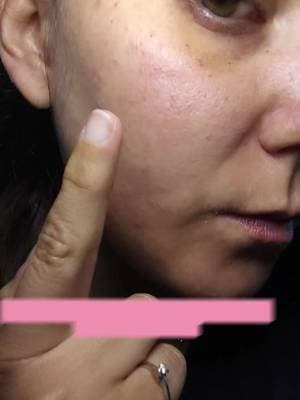#publicidad | Chicas os animo a que utilicéis la nueva herramienta IA de @La Roche-Posay que os indica el tipo de piel y el tratamiento que debes seguir. Yo ya me he hecho mi diagnóstico, aprovecha y se tú la siguiente #larocheposay #spotscan #diagnostico #skincaretips