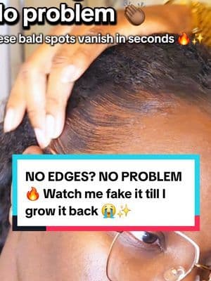 Instant edges. Instant confidence 👏🏾 The Boldify Hair Thickening Fibers legit saved my hairline after my last hairstyle took them again 😭😭—covers thinning, patchiness, and stress spots in seconds 🙌🏾💁🏾♀️ It’s sweat-proof, rain-proof, and washes right out with shampoo. Let’s just say… faking it till I grow it back 😌 ... #fyp #abbydames #OutlandishCreatorChallenge #BFCM2025 #TikTokShopBlackFriday #TikTokShopCyberMonday #HolidayDeals2025 #TikTokShopHoliday #CreatorChallenge #TikTokShopRestock #tiktokshopcreatorpicks #BahamianCreator #BahamianInfluencer #CaribbeanCreator #CaribbeanInfluencer #Austininfluencer #Austincreator #Texasinfluencer #Texascreator #UGC #TikTokpartner #TikTokShopFallDealsForYou #SuperBrandClub #ViralOnTikTokShop #TTSSouthwest #TasteMakersAustin #fallfestival #HairTok #EdgesLaid #Boldify #ThinningHair #HairFibers #RootTouchUp #ProtectiveStyles #BlackGirlMagic #HairTransformation #BaldSpotFix #ScalpCare #NaturalHairCare #BeautyHack #SelfCareRoutine #TikTokMadeMeBuyIt #ConfidenceBoost #EdgeControl #ViralBeautyFinds #HairlineRescue
