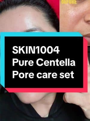 Transform your Pore care routine! Skin1004 Pore Care Set is here at 50% off 🛒because poreless clean skin never goes out of style!@SKIN1004 US #SKIN1004 #tiktokshopcreatorpicks #koreanskincare #centella #perfectporeset
