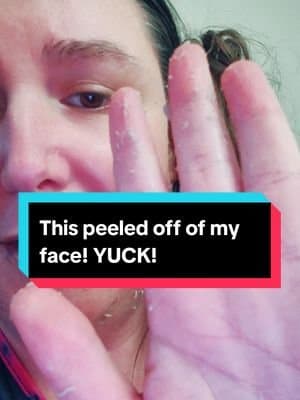 I cannot live without my dr Melaxin Peelshot. This stuff gets rid of dead skin and oil and makes your pores look amazing! #viralskincare #drmelaxin #peelshot #deepclean #facial #diyfacial #skincare #tiktokshopdealsforyoudays #tiktokshopsummersale #tiktokshopsummerturnup #deadskinremoval #oilremover #porecleaner #blackheads