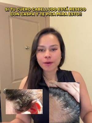 #headandshoulders #caspa #resequedad #drandruffremove #tiktokshop