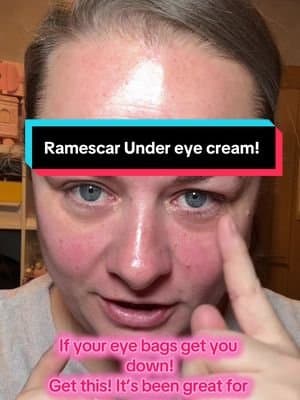 Finally a product that has worked for me after trying so many! @remescar_official #tiktokmademebuyit #dealdrops #skincare #skincaretips #undereyetreatment