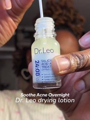 #gifted @Dr.Leo-USA salicylic acid drying lotion is unreal!!reducing my acne overnight #salicylicacid #dryinglotion