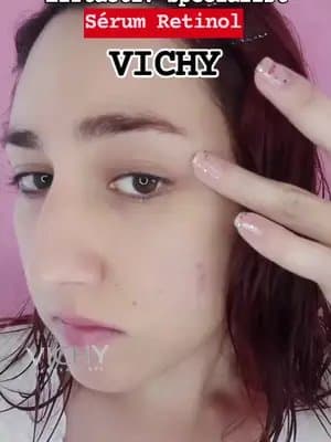 Sérum Retinol de VICHY Piel más joven y radiante #LiftActivRetinolFM #VichyLaboratoires #MEvsDARKSPOTS #darkspots #LIFTACTIV #Publicidad @vichylaboratoires @formetipsmx @For_me tips México 🇲🇽 @Vichy Laboratoires