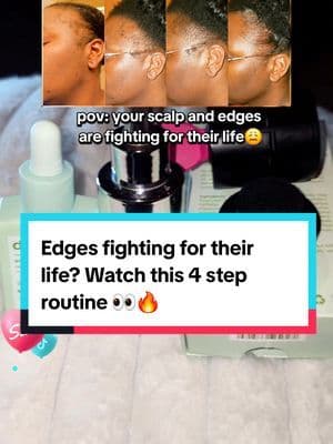 When everything from your scalp to your hairline is stressed… this 4 step routine keeps me polished every single day 👏🏾 DIVI goes all over my scalp, Cécred stays on my edges only, Root Touch Up hides the spots still filling in, and Bask and Lather Edge Control gives strong hold with castor oil support. If you see the orange cart above, it is still available for you to grab them 👀 ... #fyp #abbydames #viral #tiktokshop #hairtok #blackgirlbeauty #naturalhair #beautyhacks #texturedhaircare #creatorpick #OutlandishCreatorChallenge #BFCM2025 #TikTokShopBlackFriday #TikTokShopCyberMonday #HolidayDeals2025 #TikTokShopHoliday #CreatorChallenge #TikTokShopRestock #tiktokshopcreatorpicks #BahamianCreator #BahamianInfluencer #CaribbeanCreator #CaribbeanInfluencer #Austininfluencer #Austincreator #Texasinfluencer #Texascreator #UGC #TikTokpartner #TikTokShopFallDealsForYou #AutumnLiving #SuperBrandClub #ViralOnTikTokShop #TTSSouthwest #TasteMakersAustin #fallfestival #DIVI #DIVIserum #DIVIscalpserum #Cecred #CecredEdges #CecredHairDrops #RootTouchUp #HairFibers #BaskAndLather #BaskAndLatherEdgeControl #EdgesLaid #HairFinishing #HairlineCare #ScalpCare #ProtectiveStyles #TexturedHair #HairConfidence #homeandelectronicsdeals Disclaimer: Final price, discounts, and shipping may differ based on your TikTok account, available coupons, and current promotions. Always refer to the product listing for the most up-to-date offers. Promotion may have ended by the time you see this.
