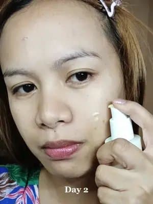 Part 52 ✅ My texture? Smoother. My smile lines? Softer. My pores? Smaller. This serum? THAT GIRL 💅✨ 🧪 Key Ingredients: ✔️ 2% Retinal Liposome – reduces fine lines & boosts collagen ✔️ 58% Black Ginseng Extract – powerful antioxidant ✔️ Niacinamide – brightens and smooths skin tone ✔️ Bakuchiol – gentle retinol alternative ✔️ Peptides – supports skin repair & elasticity 🧴 How to Use: 🌙 At night – after cleansing, apply 1-2 pumps, massage gently, then seal with moisturizer. 🌞 In the morning – don’t forget sunscreen ha, very important pag gumagamit ng retinal! ⚠️ Disclaimer: 🚫 Do a patch test before full use 🚫 Bawal sa open wounds or broken skin 🚫 Start 2–3x a week kung sensitive skin ka 🌤️ Always wear sunscreen during the day! ✨ Visible results in just a few weeks – glow up ang peg! 🛒 Where to buy: Amazon, Yesstyle, Stylevana, Stylekorean @KSECRET GLOBAL #glowupwithretinalchallenge #ksecret #seoul1988 #RetinalSerum #AntiAgingSkincare #KSecretSeoul1988 #KoreanSkincarePH #GlowingSkinTips #TikTokMadeMeBuyIt #PeptideSerum #RetinolAlternative #KBeautyFinds Anti-aging Wrinkle reduction Smile lines Large pores Uneven texture Skin smoothing Brightening Firming Retinal serum Multi-use skincare