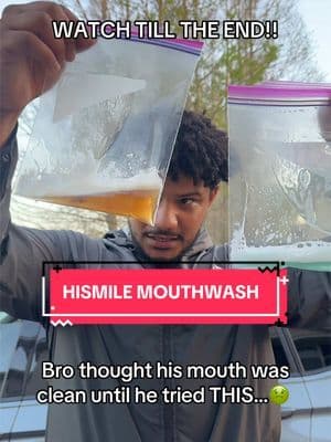 #hismile #mouthwash #yellowteeth #teethwhitening #tiktokmademebuyit