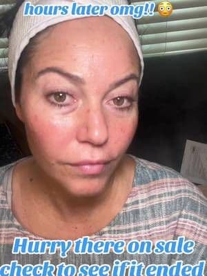 Amazing results for irritation relief. This is on a huge sale. Check to see if it’s still going on in the cart.@@dear, Klairs##tiktokshopblackfriday##tiktokshopcreatorpicks##rednessreliefskincare