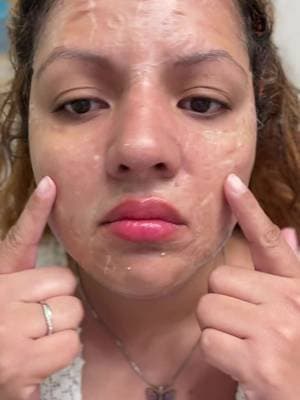 La mascarilla que se hizo mega viral en TikTok y ahora entiendo por qué. El SKIN1004 Zombie Pack ayuda a minimizar la apariencia de los poros y suavizar la textura de la piel. #SKIN1004 #tiktokshopcreatorpicks #koreanskincare #centella #skincare @SKIN1004 US