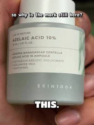 You know when the breakout is gone but the little mark it left behind is still hanging around? 😭 That’s exactly why azelaic acid stays in my routine. I’ve been using the @SKIN1004 US Azelaic Acid 10 Ampoule for visible redness, post-acne marks, and uneven-looking tone — basically the aftermath I’d rather work on than keep covering. #skin1004 #centella #azelaicacid #acneproneskin #TikTokMadeMeBuyIt