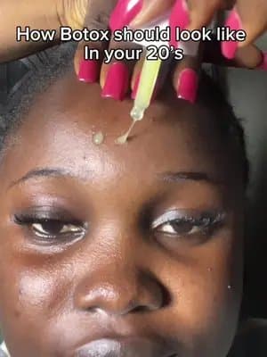 How Botox should look like in your 20s. @SKIN1004 US #goviralwithskin1004challenge #skin1004retinolshot #centella #skin1004 #Tiktokmademebuyit #koreanskincare #kbeauty #skincareroutines