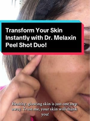 #creatorsearchinsights Say goodbye to dull skin and hello to a radiant glow! 🌟 Dr. Melaxin Peel Shot Glow Rice Ampoule Duo is the ultimate exfoliator and hydrator in one. See results after just ONE use! #GlowUp #SkincareRoutine #ExfoliateAndHydrate #DrMelaxin #RadiantSkin #BeautyEssentials #GlowUp #RadiantSkin #SkincareGoals #PeelAmpoule #ExfoliateAndHydrate #KBeautyLove #GentleExfoliation #BeautyTips #SkincareLovers #tiktokmademebuyit