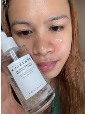 Too dry, too oily? Balance it! #GoViralWithSKIN1004Challenge #SKIN1004White #skin1004 #centella #TikTokMadeMeBuyIt @skin1004_challenge @SKIN1004 US