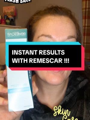Immediate impact with Remescar Neck & Décolleté Corrective Skincare Lifts, tightens, and transforms. Our "Instant Results" formula targets sagging and fine lines on the neck and chest in only 5 minutes. Perfect for daily use or special occasions, with enough product for 85 applications to keep you looking your best. #women #antiaging #skincare #tiktokmademebuyit #fyp @remescar_official