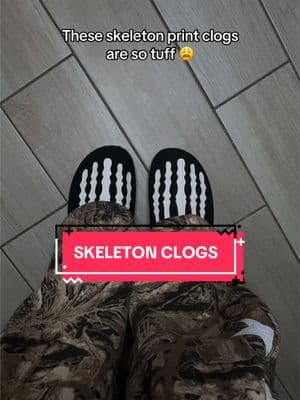 #clogs #slides #streetwear #crocsclogs #tiktokmademebuyit