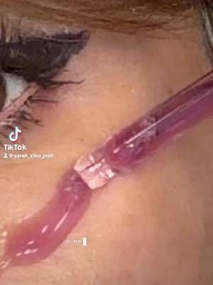 @Dr.Melaxin #drmelaxin #drmelaxinskincare #drmelaxinpeelshot #TikTokShopCreatorPics #TikTokShopRestock