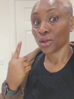 You do not need a lip filler when you can get this lip plumper. @Dr.Melaxin Global @Dr Melaxin® #nofillers #lipmoisturiser #plumplips #Drmelaxin #tiktokmademebuyit