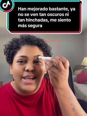 Funcionaba yo probé todo y mis ojeras no se aclaraban ni se deshinchaba. Este producto me ha ayudado a desinflamar mis ojeras y aclarar el tono de ellas lo cual me ha ayudado bastante me siento más segura amo como se está viendo mi rostro ya no me veo tan cansada@Innisfree US #skincare #ojos #ojeras #skincareeye #tiktokshop #skincare #skincareroutinestepbystep #greenteapdrnfirmingserumunboxing #greenteapdrnfirmingserumreview #skincareroutinemusthave #thebrighteningbodyserum #superhydratingskincareroutine #skincareroutine✨ #jiyuskincareantiagingroutine #thrivecausemeticsbrillianteyebrightener #brighteningskincareroutine