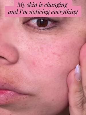 My pores have definitely been looking bigger lately and I know it is from losing elasticity as I get older. I started using this deep pore cleansing clay mask with Amazonian clay and it actually pulls out oil, dirt, and buildup instead of just sitting on my skin. It helps clear blackheads, smooth texture, and leaves my skin looking cleaner and tighter. If your skin has been feeling congested or your pores are more noticeable, this is worth trying. @Dr.Leo-USA #skincare #drleo #tiktokshopspringglowup #over35 #skincareroutine