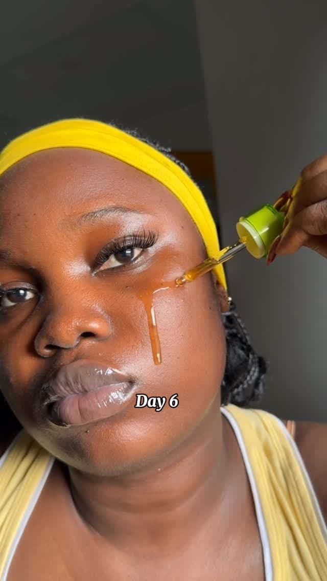 Acne nd blemishes product reviews